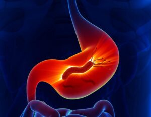 , When Heartburn Is a Signal, Not Excess, Nia Pure Nature